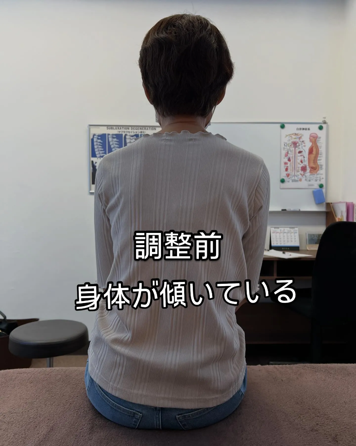 【症例紹介】60代女性　左足の痛みと痺れで来院