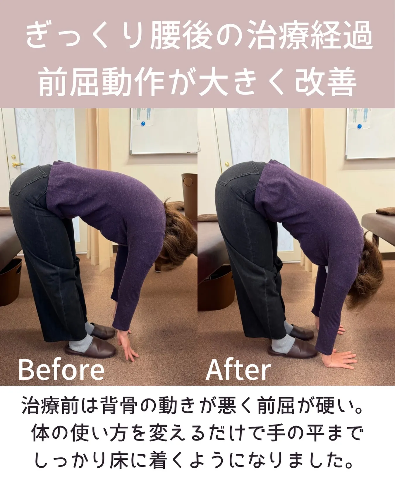 【ぎっくり腰になりやすい方へ】川西市 腰痛