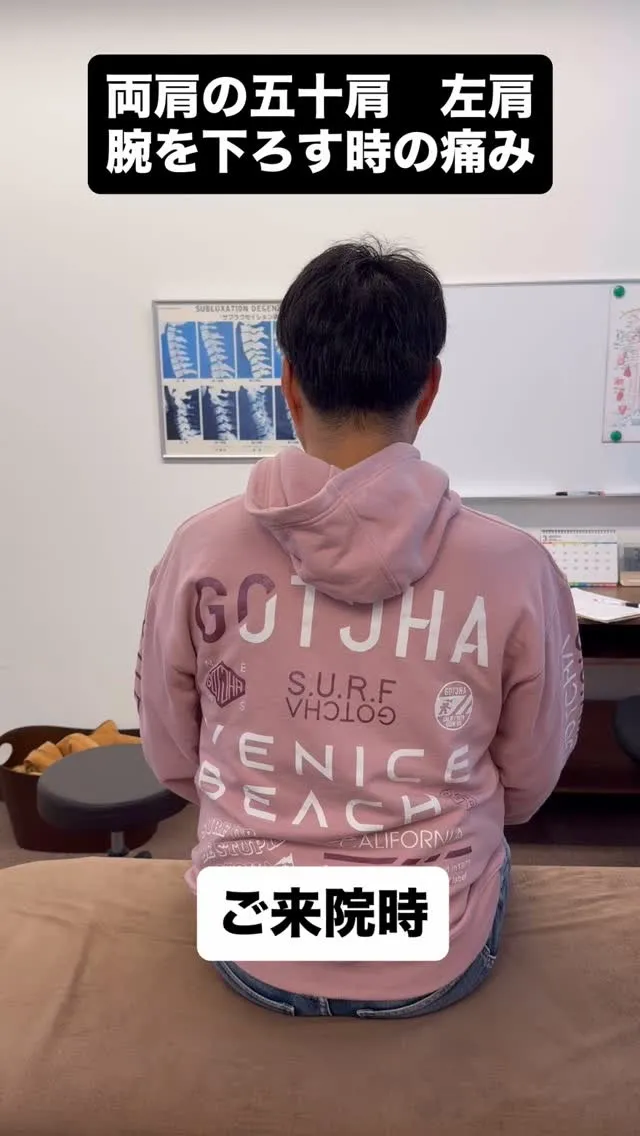 重症の五十肩で腕が上がらなかった50代男性。