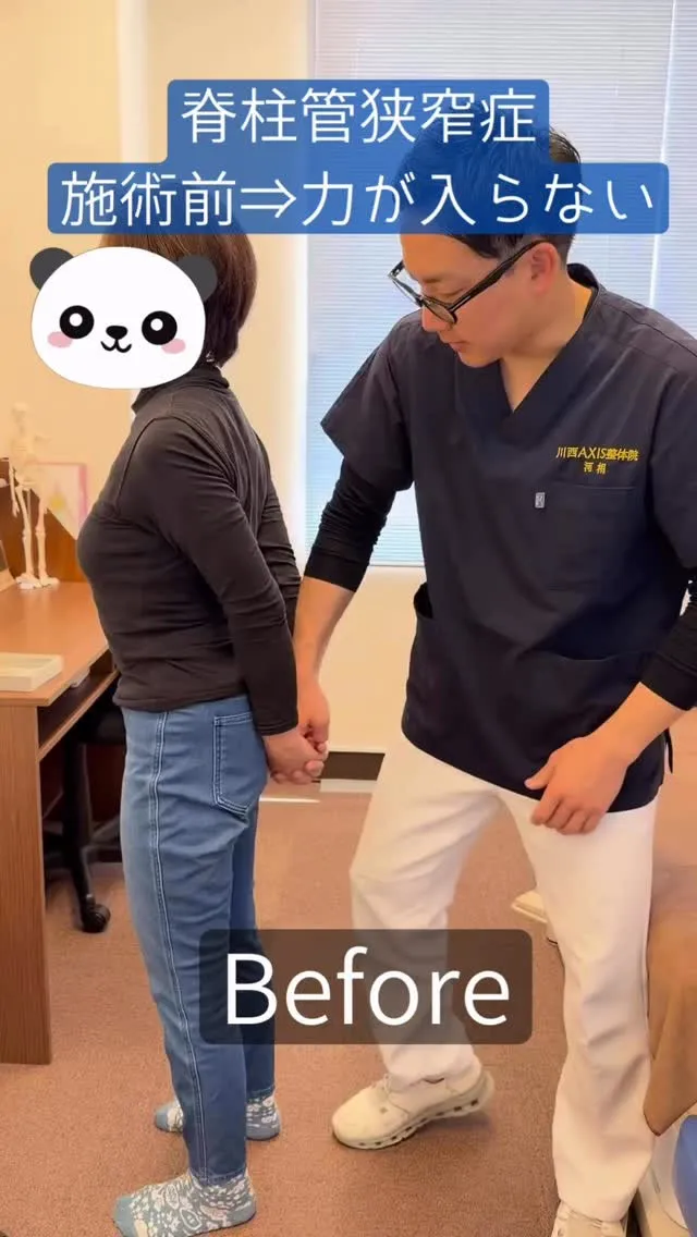 【川西市 70代女性 脊柱管狭窄症】